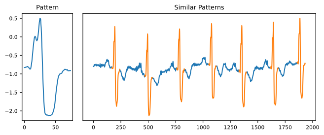 Pattern Detection in Time Series Analysis